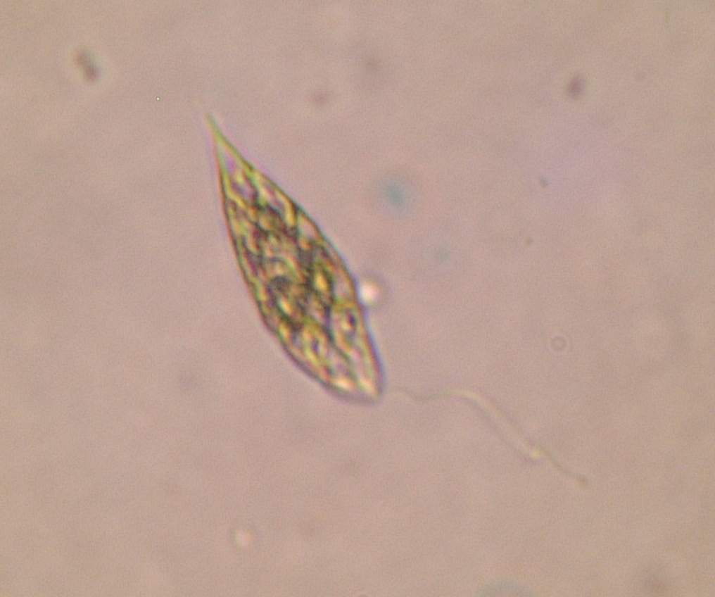 Euglena_sp.jpg